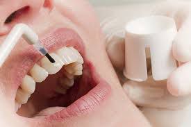 Укрепление и защита эмали